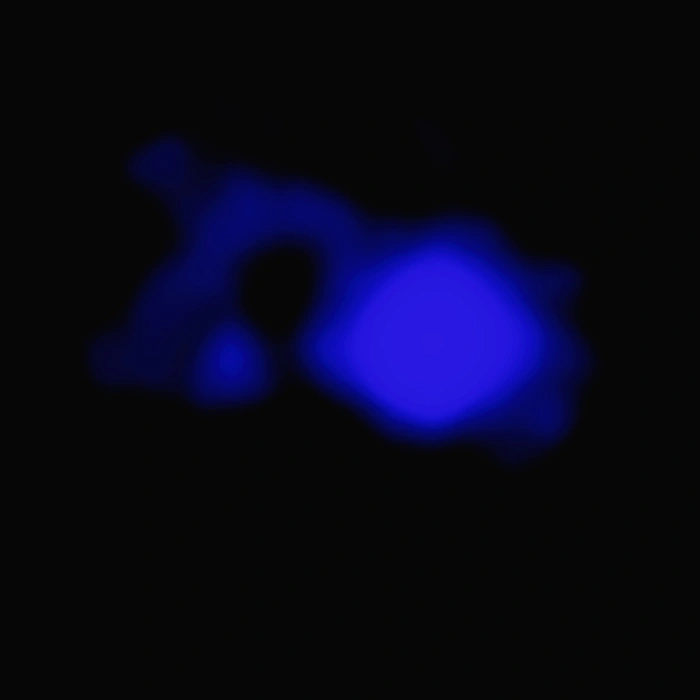 teacup galaxy chandra x-ray observatory