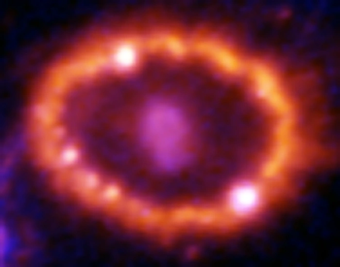 ring around sn 1987a