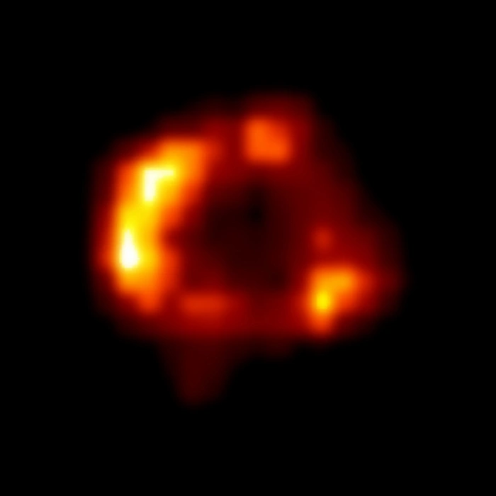 sn 1987 chandra image