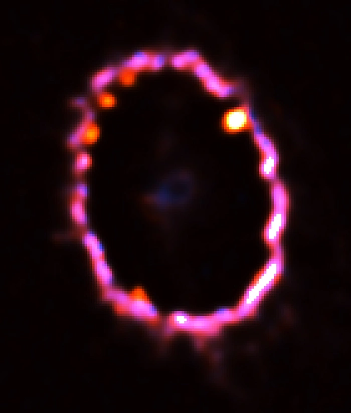 sn 1987a ring of gas